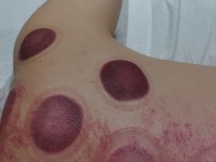 -首匠推拿养生中心(君地新大陆店)