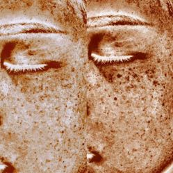 -和颜一美轻医美连锁