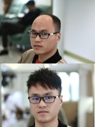 -发饰美男士增发补发假发定制店