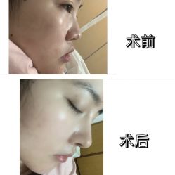 -西安壹加壹医疗美容·西北抗衰旗舰店