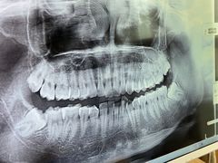 -同步齿科·数字化正畸种植口腔中心(珠海店)
