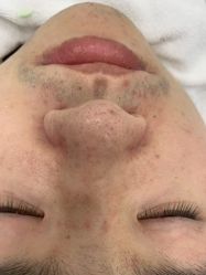 -蕾特恩专业祛痘·皮肤管理