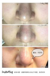 脸部抗衰-光SPA科技美肤