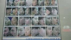 点击看大图 -痘博士广州·全国连锁祛痘机构