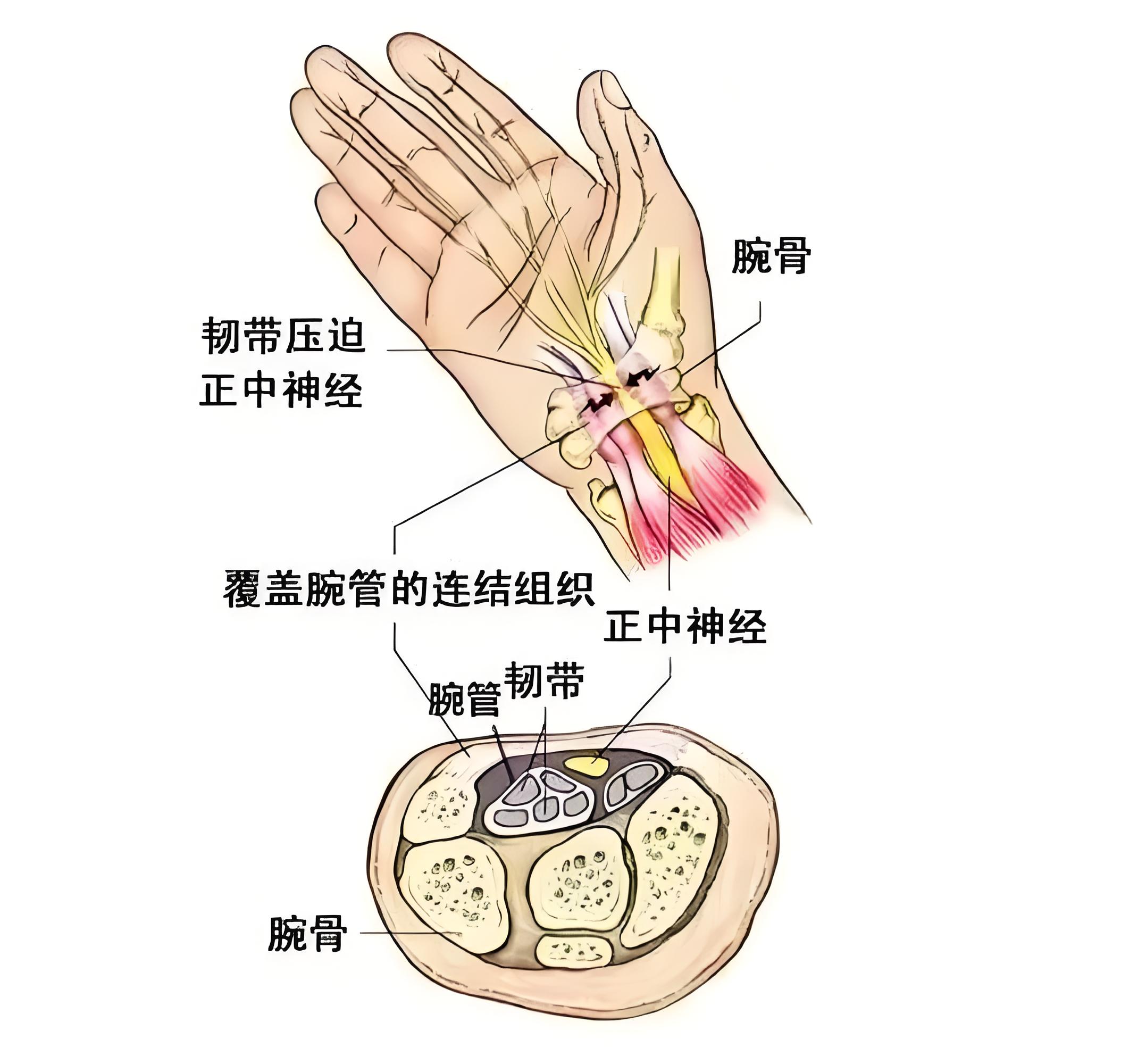 腕管结构图片