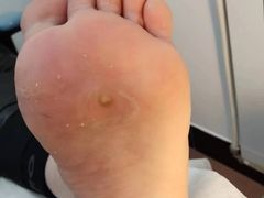 -世龙世家灰指甲鸡眼脚气甲沟炎跖疣护理(通州店)