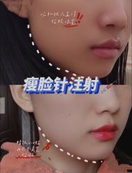 -上海漾颜医疗美容