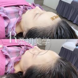 -RC半永久纹眉纹发际线