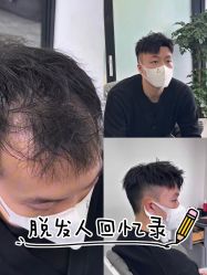 -唐风采假发补发定制