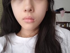 点击看大图 体验前-Yestar 嘉兴艺星医疗美容医院