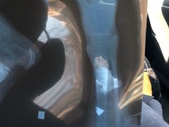 -大韩庄韩氏祖传正骨