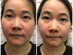 -修申骨雕小颜脊柱骨盆管理产后修复