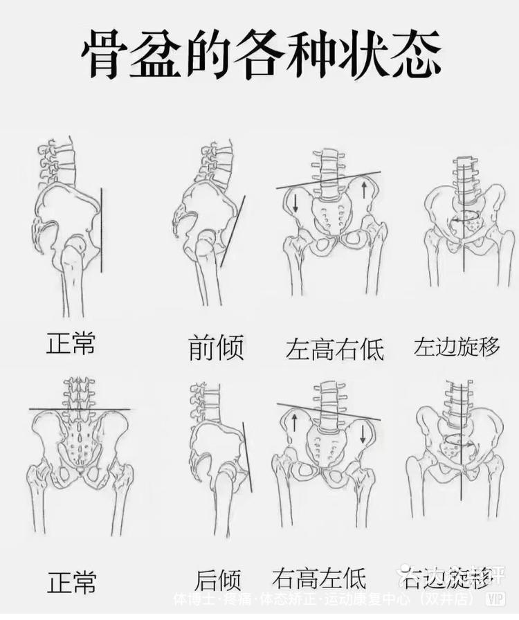 骨盆下面观图片