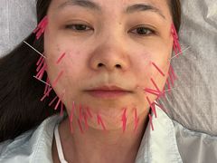 -承启堂中医馆·推拿·针灸·把脉(青羊馆)