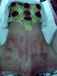 -苑苑vbeauty科技美容SPA