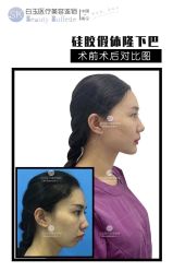 -广西颜白玉医疗美容门诊部