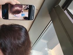 -碧莲盛·不剃发植发