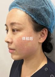 点击看大图 体验后-脸博士医疗美容·眼鼻整形·抗衰中心