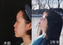 -北京米扬丽格医疗美容·联合丽格鼻整形中心