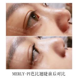-MLP美丽派·问题肌疗愈中心
