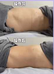 -Lily纤美·科技减脂中心