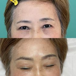 点击看大图 -杨益美学·野生眉半永久纹眉发际线