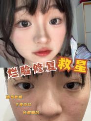 -香榭丽舍·海菲秀·皮肤管理痘敏肌修护