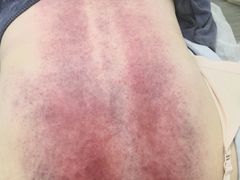 -张钰强中医正骨推拿连锁(唐家人才公寓店)
