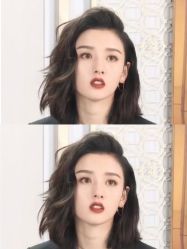 -广州美莱医疗美容医院