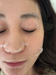 -海涛医疗美容·面部抗衰·注射美鼻