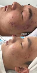点击看大图 -痘庄科学祛痘国际连锁
