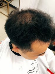 -发饰美男士增发补发假发定制店
