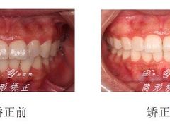 -Dr.Z dental仁康种植矫正中心