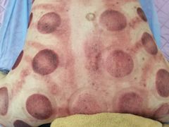 -郑师傅祖传推拿安波路(安波路200弄小区店)