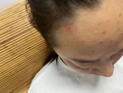-百年美肤堂祛痦痣祛斑祛疣