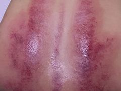 -赵氏盲人按摩(武林门店)