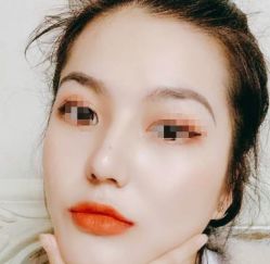 点击看大图 -SKINIST丽铂医疗美容