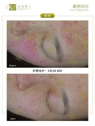 -E.beauty驻颜·痘敏肌调理中心