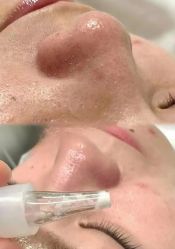 -SKIN79皮肤管理中心