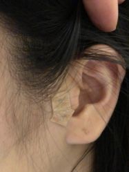 -肥三针腧穴瘦身馆