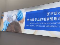 体验前-大麦微针植发全国连锁