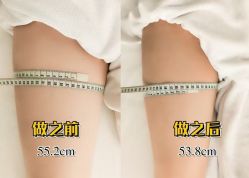 -Lily纤美·科技减脂中心
