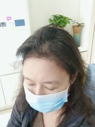 -大麦微针植发丨全国连锁