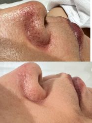 体验前-康美贞·痘肌养护管理中心