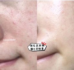 -E.beauty驻颜·痘敏肌调理中心