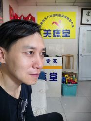 点击看大图 -北京美痣堂古方祛痣斑疣瘊