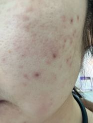 -广州美莱医疗美容医院