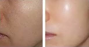 -SKINIST丽铂医疗美容