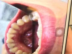 -微笑牙科口腔(三亚迎宾院区)