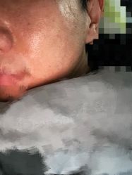 -张小熊连锁轻医美